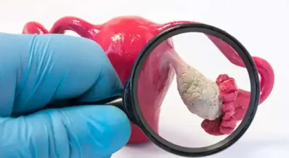 Histerossonossalpingografia (HyCoSy)