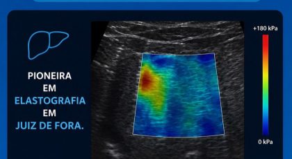 ELASTOGRAFIA